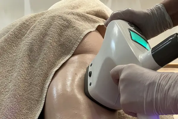 Foto Ultrashape