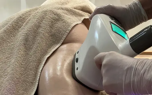 Foto Ultrashape