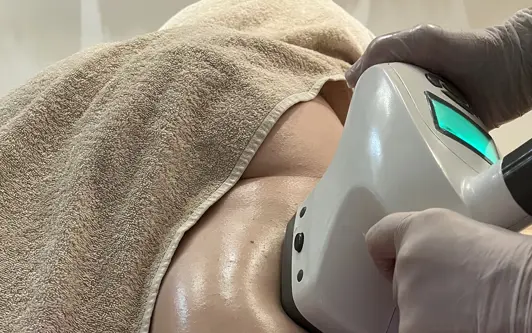 Foto Ultrashape (1)